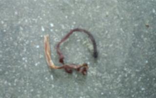 ステップ8 ステップ8